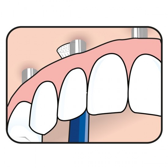 Tepe Universal Care Οδοντόβουρτσα με Γωνία Κλίσης 1 Τεμάχιο